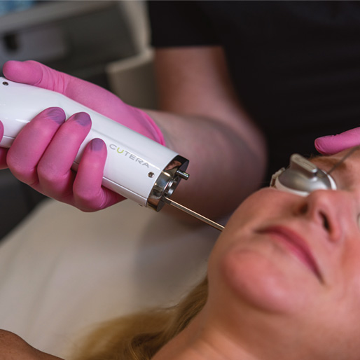 Pico technology vs. IPL & How to Choose the One for You